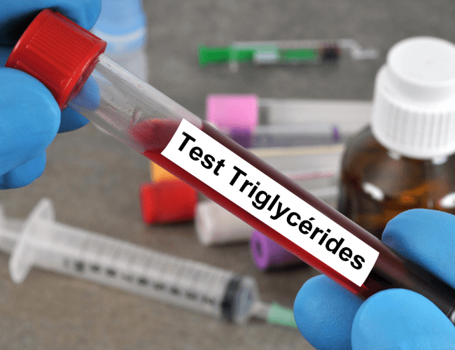 Alteración de triglicéridos, colesterol y ácido úrico