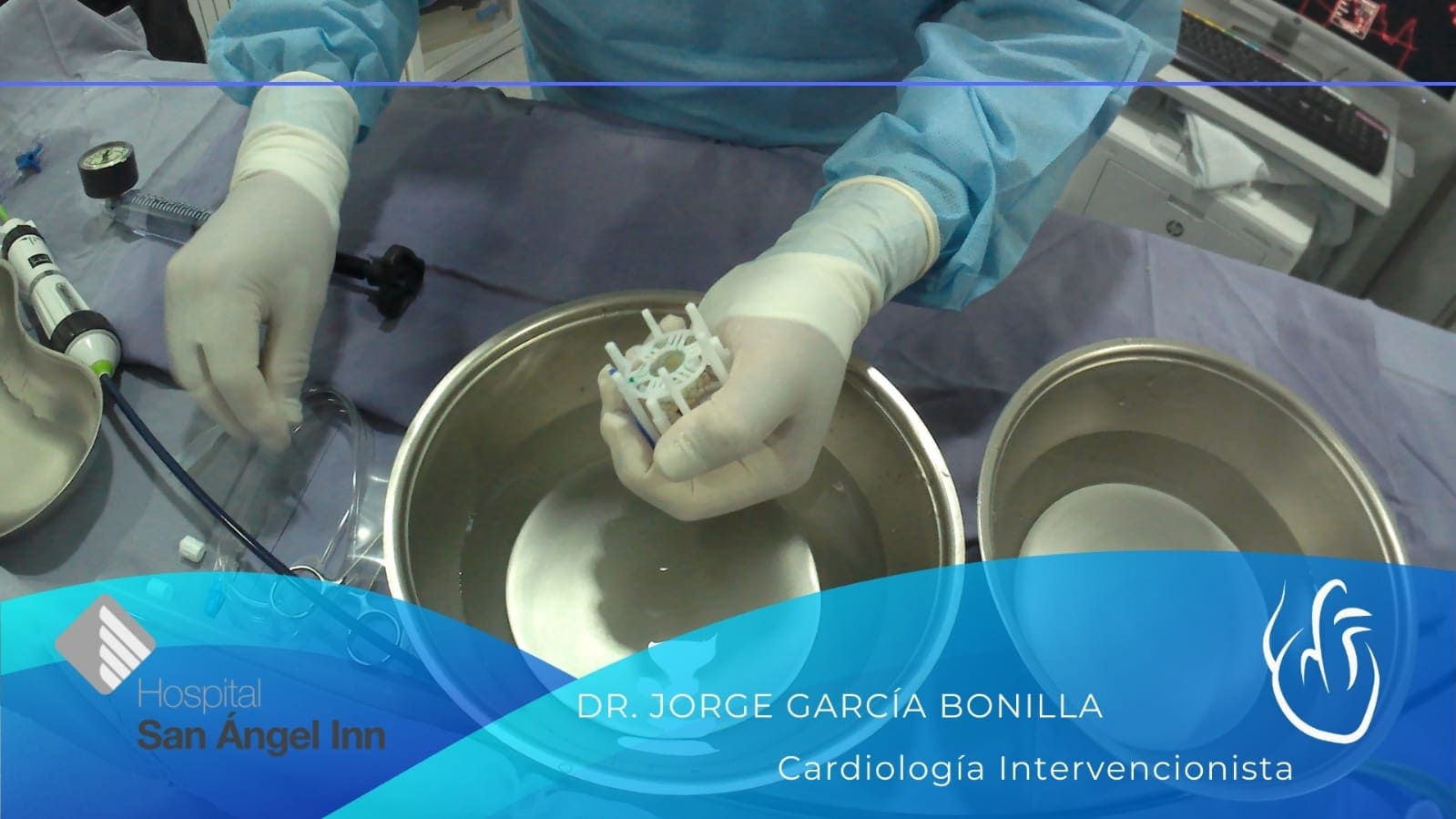 Cardiología intervencionista en CDMX