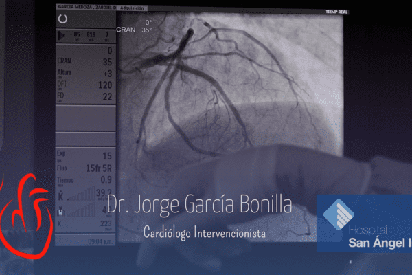 Cardiología intervencionista en CDMX