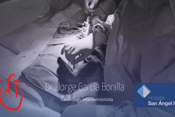 Cardiología intervencionista en CDMX